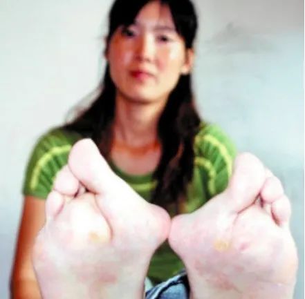 举重蹲举_举重后蹲世界纪录_举重冠军过头蹲怎么练