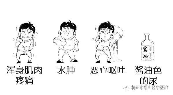 健身房锻炼肌肉拉伤_肌肉锻炼拉伤怎么办_健身房运动肌肉拉伤